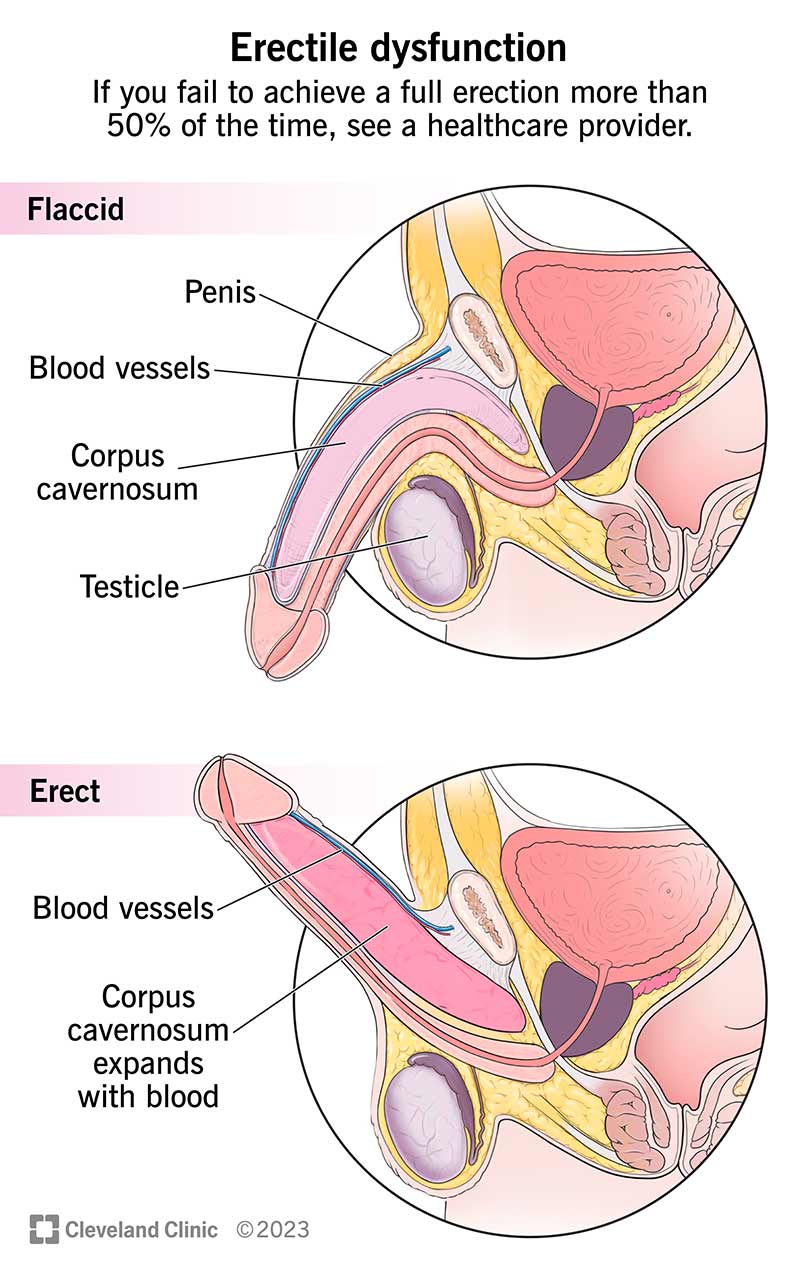 ED solution